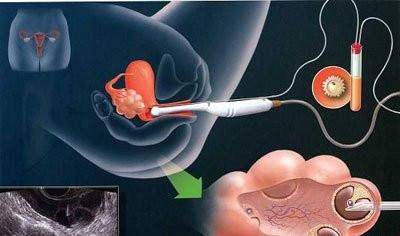 案例